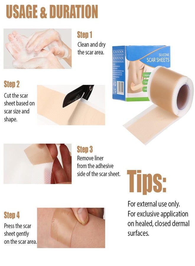 Yeasing Silicone Scar Sheets 1.57" x 19.68" Silicone Skin Patches C Section Recovery Extra Long Silicone Scar Tape Scar Removal Strips Tummy Tuck Tape for Acne Scars C-Section Keloid - Image 4